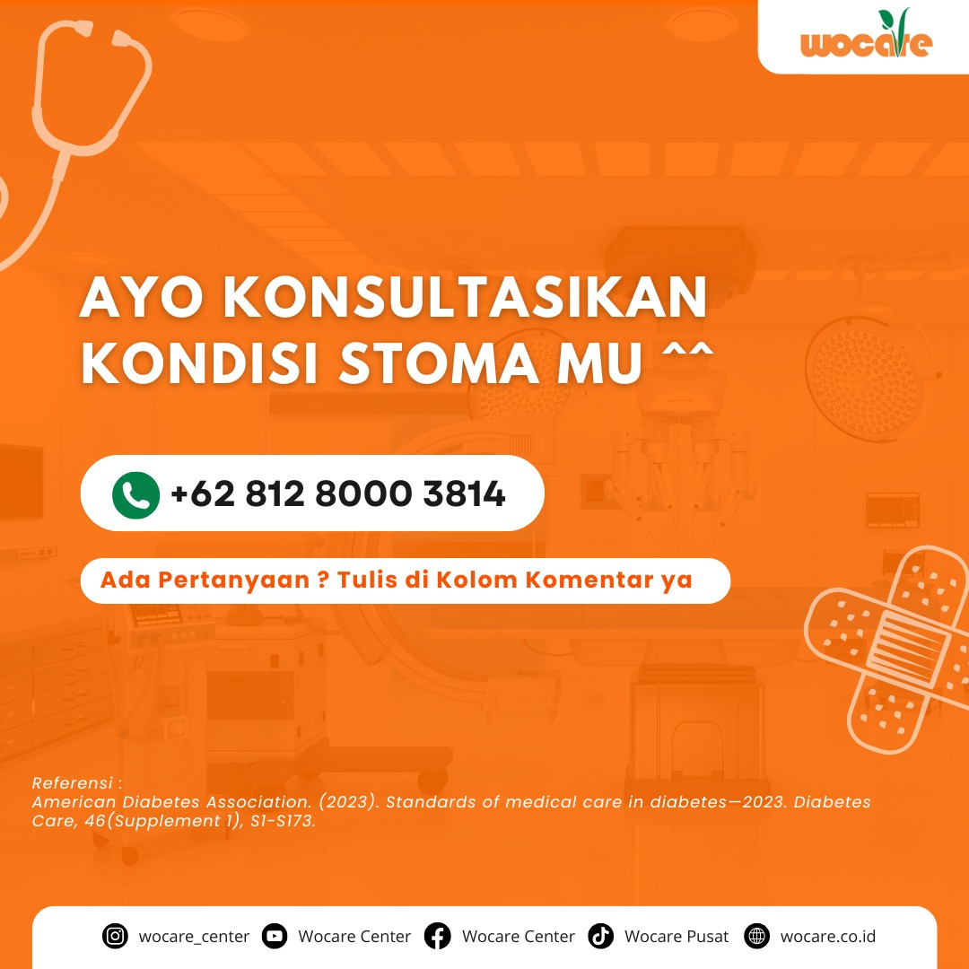 LAYANAN PERAWATAN STOMA GRATIS