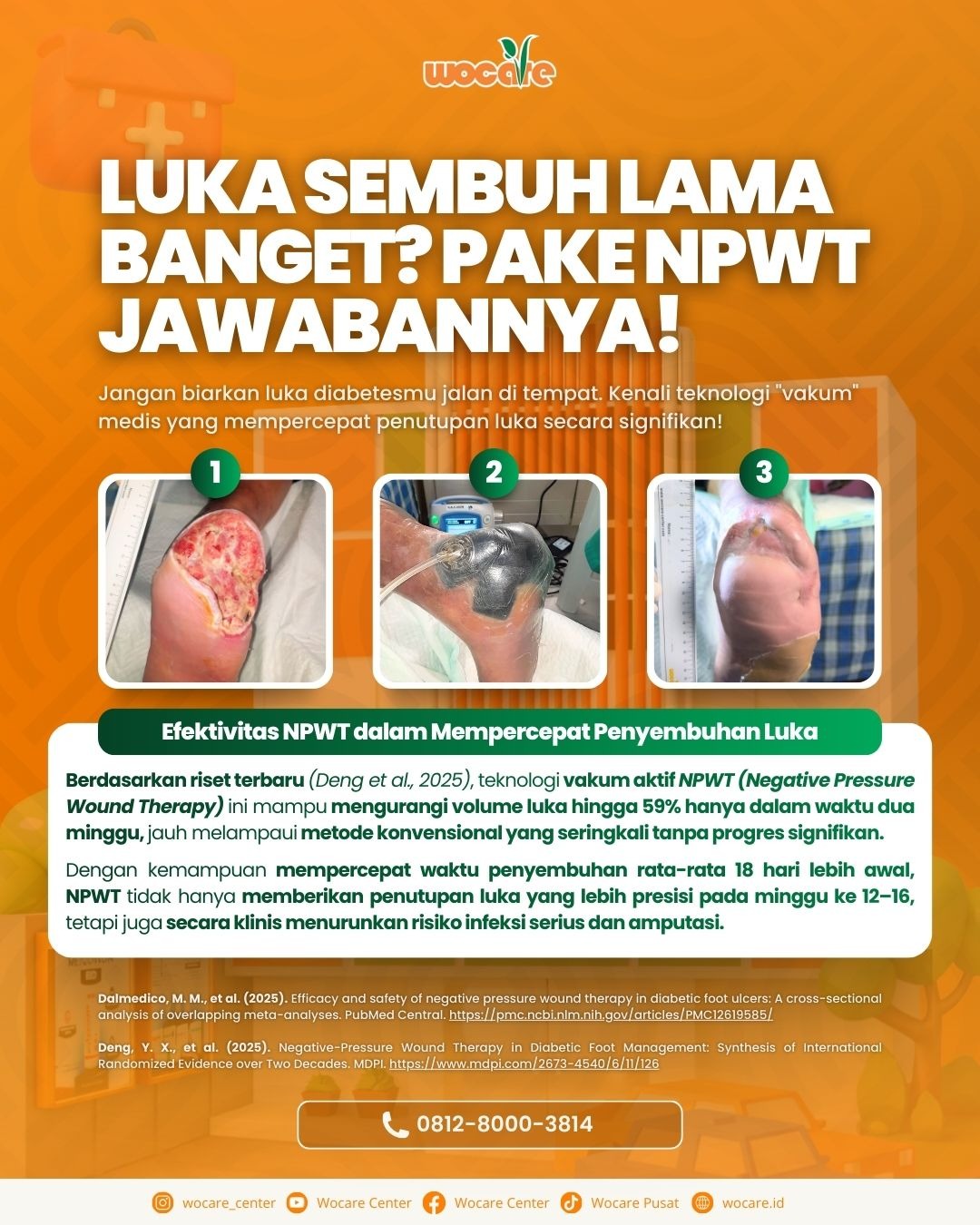 Revolusi Penyembuhan Luka: Bagaimana NPWT Mempercepat Kesembuhan Luka Kronis