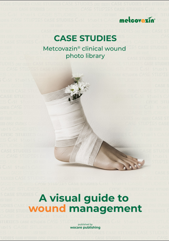 Metcovazin Wound Atlas